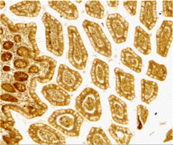 CD209 Antibody