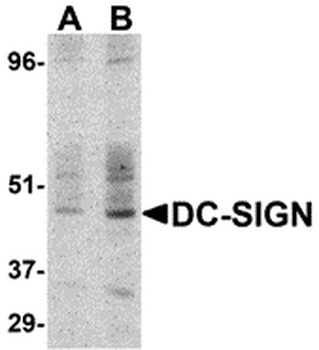 CD209 Antibody