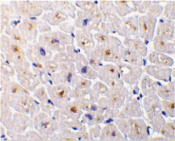 TNFRSF6B Antibody