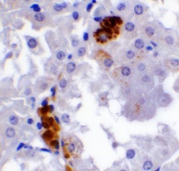 PPARGC1A Antibody