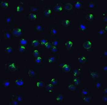 PPARGC1A Antibody