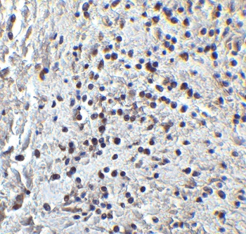 PPARGC1A Antibody