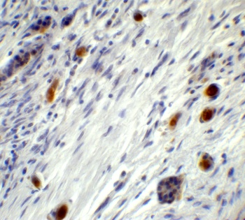 PPARGC1A Antibody