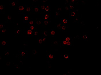 DcR1 Antibody