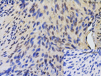 PRDM16 Antibody
