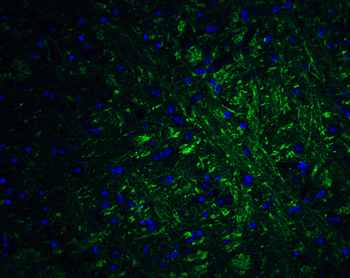 PRDM16 Antibody