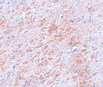 DCLK2 Antibody