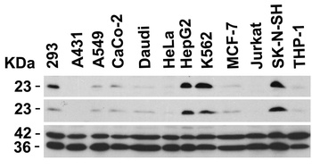 PUMA Antibody