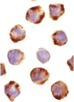 PUMA Antibody