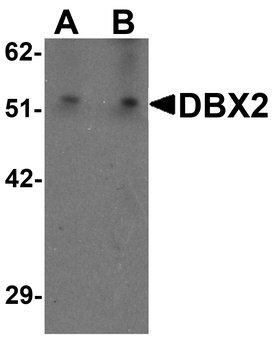 DBX2 Antibody