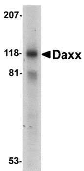 DAXX Antibody