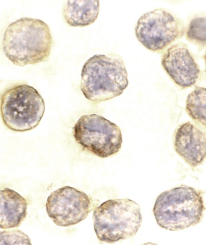 DAXX Antibody