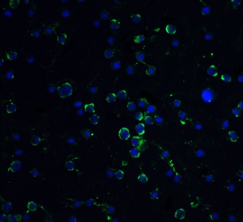 DAXX Antibody