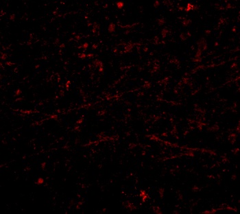 DARC Antibody