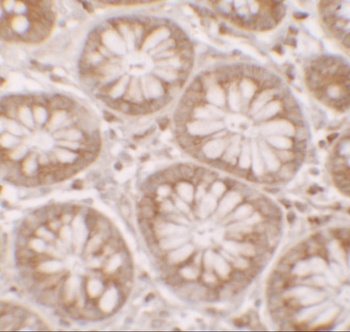 DAP Antibody