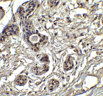 PUMA Antibody