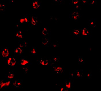 PUMA Antibody