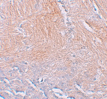 CXXC5 Antibody