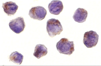 RICK Antibody