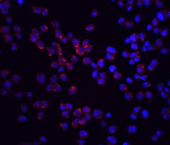 RIPK2 Antibody