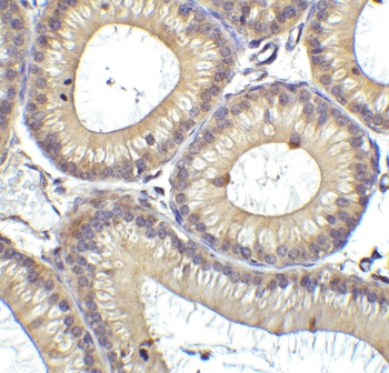 DDX58 Antibody