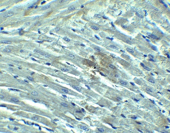 RIG-1 Antibody