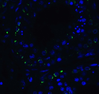 DDX58 Antibody