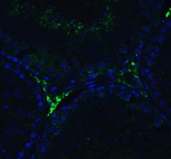 DDX58 Antibody