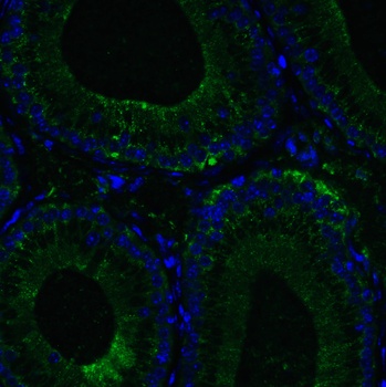 RIG-1 Antibody