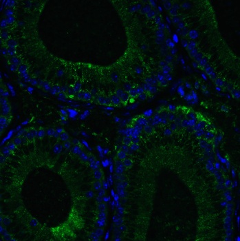 DDX58 Antibody