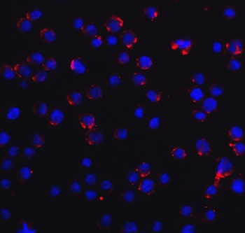 DDX58 Antibody