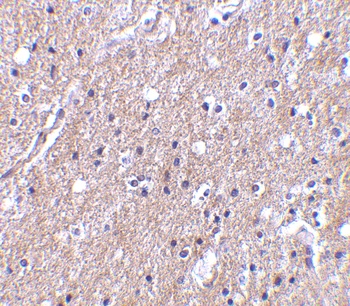 C1QTNF6 Antibody