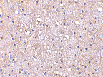 CTRP5 Antibody