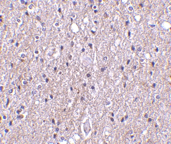 C1QTNF4 Antibody