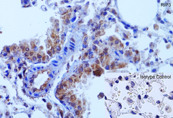 RIP3 Antibody