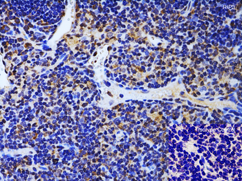 RIP3 Antibody