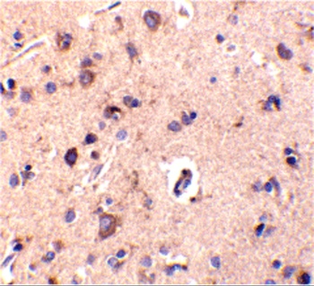 C1QTNF2 Antibody