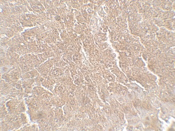 RPSA Antibody