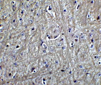 RPSA Antibody