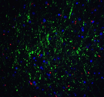 RPSA Antibody