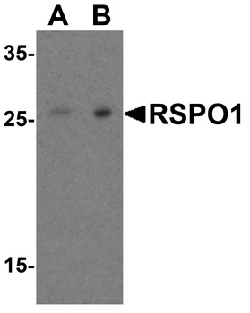 RSPO1 Antibody