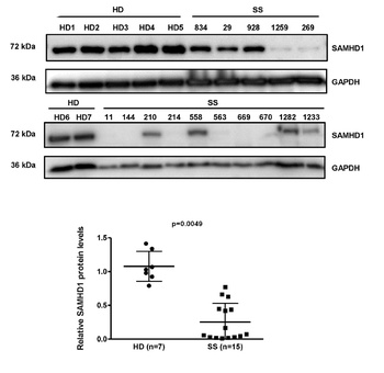 SAMHD1 Antibody