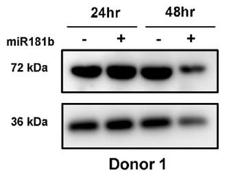 SAMHD1 Antibody