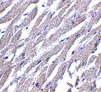CRTH2 Antibody