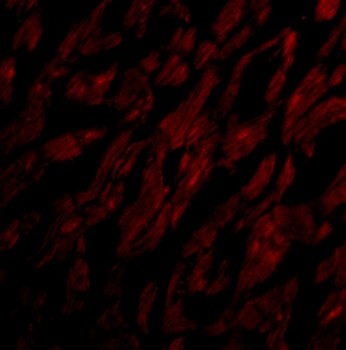 CRTH2 Antibody