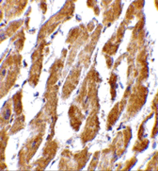 PTGDR2 Antibody