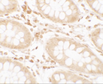 CRTC2 Antibody