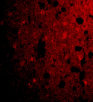 CRMP1 Antibody