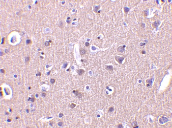 CRMP1 Antibody