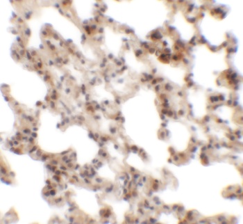 Coronin 7 Antibody